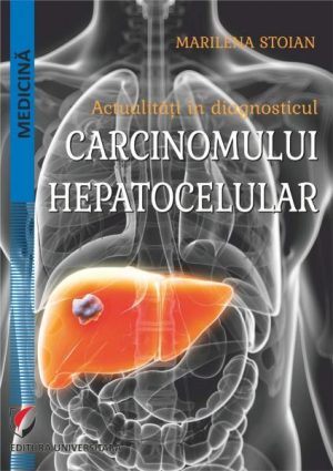 Actualitati in diagnosticul carcinomului hepatocelular